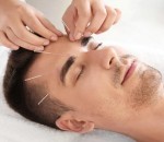 طب سوزنی و بوتاکس در بابل