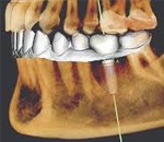 تدریس خصوصی ریاضی در بابل